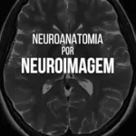خرید و دانلود نسخه کامل کتاب زبان اصلی NEUROANATOMIA POR NEUROIMAGEM (Portuguese Edition) PDF | دانلود کتاب خارجی