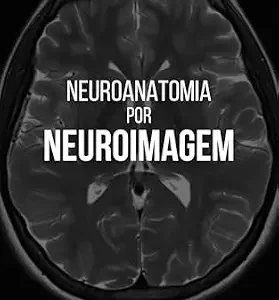 خرید و دانلود نسخه کامل کتاب زبان اصلی NEUROANATOMIA POR NEUROIMAGEM (Portuguese Edition) PDF | دانلود کتاب خارجی