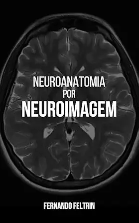 خرید و دانلود نسخه کامل کتاب زبان اصلی NEUROANATOMIA POR NEUROIMAGEM (Portuguese Edition) PDF | دانلود کتاب خارجی_6a93563f59037.webp خرید و دانلود نسخه کامل کتاب زبان اصلی NEUROANATOMIA POR NEUROIMAGEM (Portuguese Edition) PDF | دانلود کتاب خارجی