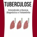خرید و دانلود نسخه کامل کتاب زبان اصلی Tuberculose Entendendo a Doença, Diagnóstico e Tratamento: Estudo completo da Tuberculose (Portuguese Edition) PDF | دانلود کتاب خارجی