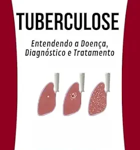 خرید و دانلود نسخه کامل کتاب زبان اصلی Tuberculose Entendendo a Doença, Diagnóstico e Tratamento: Estudo completo da Tuberculose (Portuguese Edition) PDF | دانلود کتاب خارجی