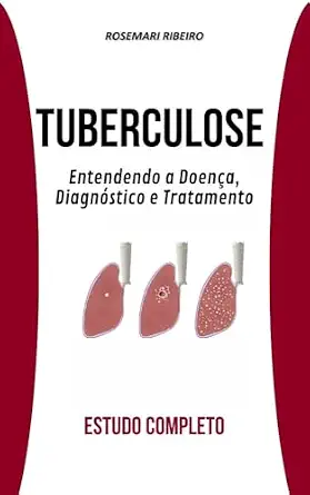 خرید و دانلود نسخه کامل کتاب زبان اصلی Tuberculose Entendendo a Doença, Diagnóstico e Tratamento: Estudo completo da Tuberculose (Portuguese Edition) PDF | دانلود کتاب خارجی_6a9354396697a.webp خرید و دانلود نسخه کامل کتاب زبان اصلی Tuberculose Entendendo a Doença, Diagnóstico e Tratamento: Estudo completo da Tuberculose (Portuguese Edition) PDF | دانلود کتاب خارجی
