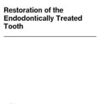 خرید و دانلود نسخه کامل کتاب Restoration of the Endodontically Treated Tooth
