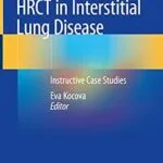 خرید و دانلود نسخه کامل کتاب HRCT in Interstitial Lung Disease: Instructive Case Studies