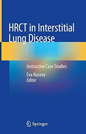 خرید و دانلود نسخه کامل کتاب HRCT in Interstitial Lung Disease: Instructive Case Studies_6a6effbf20788.jpeg خرید و دانلود نسخه کامل کتاب HRCT in Interstitial Lung Disease: Instructive Case Studies
