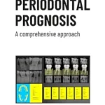 خرید و دانلود نسخه کامل کتاب Periodontal prognosis. A comprehensive approach