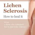 خرید و دانلود نسخه کامل کتاب Lichen Sclerosis How to heal it: At last…a doctor who understands how to treat lichen sclerosis