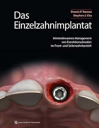 خرید و دانلود نسخه کامل کتاب Das Einzelzahnimplantat: Minimalinvasives Management von Extraktionsalveolen im Front- und Seitenzahnbereich (German Edition)_6a6795353d9ca.jpeg خرید و دانلود نسخه کامل کتاب Das Einzelzahnimplantat: Minimalinvasives Management von Extraktionsalveolen im Front- und Seitenzahnbereich (German Edition)