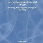 خرید و دانلود نسخه کامل کتاب Interpreting Musculoskeletal Images: Anatomy, Pathology and Emergency Reporting