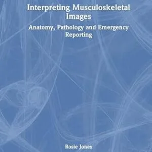 خرید و دانلود نسخه کامل کتاب Interpreting Musculoskeletal Images: Anatomy, Pathology and Emergency Reporting