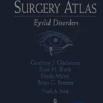 خرید و دانلود نسخه کامل کتاب Oculoplastic Surgery Atlas: Eyelid Disorders