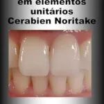 خرید و دانلود نسخه کامل کتاب Cerâmicas em Elementos Unitários (Portuguese Edition)