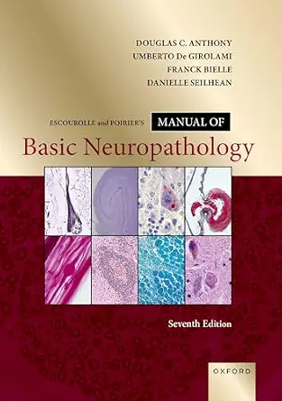 خرید و دانلود نسخه کامل کتاب Escourolle and Poirier’s Manual of Basic Neuropathology_6a7ac6cab3a38.webp خرید و دانلود نسخه کامل کتاب Escourolle and Poirier’s Manual of Basic Neuropathology