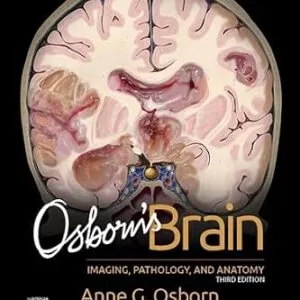 خرید و دانلود نسخه کامل کتاب Osborn’s Brain E-Book