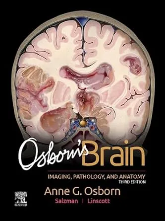 خرید و دانلود نسخه کامل کتاب Osborn’s Brain E-Book_6a6cfb178f9c2.jpeg خرید و دانلود نسخه کامل کتاب Osborn’s Brain E-Book