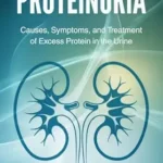 خرید و دانلود نسخه کامل کتاب Proteinuria : Causes, Symptoms, and Treatment of Excess Protein in the Urine