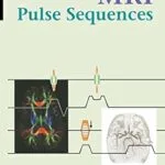 خرید و دانلود نسخه کامل کتاب Handbook of MRI Pulse Sequences