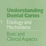 خرید و دانلود نسخه کامل کتاب Understanding Dental Caries: Vol. 1: Etiology and Mechanisms Basic and Clinical Aspects