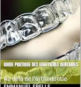 خرید و دانلود نسخه کامل کتاب GUIDE PRATIQUE DES GOUTTIÈRES DENTAIRES : Au delà de l’orthodontie (French Edition)