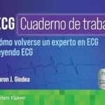 خرید و دانلود نسخه کامل کتاب ECG. Cuaderno de trabajo. Cómo volverse un experto en ECG leyendo ECG (Spanish Edition)