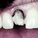 خرید و دانلود نسخه کامل کتاب Tooth-Colored Restorations: Underlying Physics