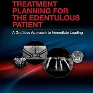 خرید و دانلود نسخه کامل کتاب Implant Treatment Planning for the Edentulous Patient: A Graftless Approach to Immediate Loading
