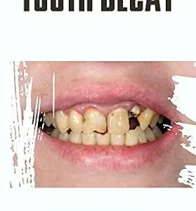 خرید و دانلود نسخه کامل کتاب TOOTH DECAY: Symptoms, Causes, Treatment, and Prevention