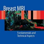 خرید و دانلود نسخه کامل کتاب Breast MRI: Fundamentals and Technical Aspects