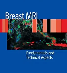 خرید و دانلود نسخه کامل کتاب Breast MRI: Fundamentals and Technical Aspects
