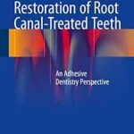 خرید و دانلود نسخه کامل کتاب Restoration of Root Canal-Treated Teeth: An Adhesive Dentistry Perspective