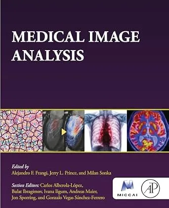 خرید و دانلود نسخه کامل کتاب Medical Image Analysis (The MICCAI Society book Series)_6a70725a93f8e.jpeg خرید و دانلود نسخه کامل کتاب Medical Image Analysis (The MICCAI Society book Series)