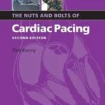 خرید و دانلود نسخه کامل کتاب The Nuts and Bolts of Cardiac Pacing (Nuts and Bolts Series (Replaced by 5113) Book 12)