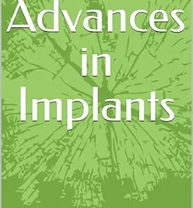 خرید و دانلود نسخه کامل کتاب Recent Advances in Implants