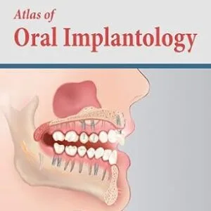 خرید و دانلود نسخه کامل کتاب Atlas of Oral Implantology – E-Book