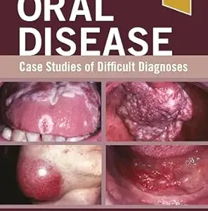 خرید و دانلود نسخه کامل کتاب Oral Disease: Case Studies of Difficult Diagnoses – E-Book