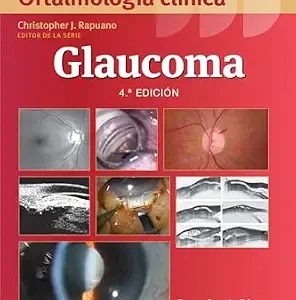 خرید و دانلود نسخه کامل کتاب Wills Eye Hospital. Atlas en color y sinopsis de oftalmología clínica. Glaucoma (Wills Eye Institute Atlas Series) (Spanish Edition)