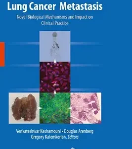 خرید و دانلود نسخه کامل کتاب Lung Cancer Metastasis: Novel Biological Mechanisms and Impact on Clinical Practice
