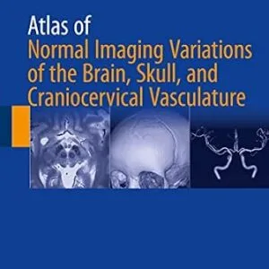 خرید و دانلود نسخه کامل کتاب Atlas of Normal Imaging Variations of the Brain, Skull, and Craniocervical Vasculature