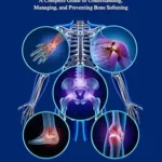 خرید و دانلود نسخه کامل کتاب Osteomalacia: A Complete Guide to Understanding, Managing, and Preventing Bone Softening (The Bone Wellness Guide Series)