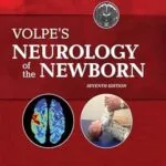 خرید و دانلود نسخه کامل کتاب Volpe’s Neurology of the Newborn E-Book