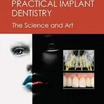 خرید و دانلود نسخه کامل کتاب Practical Implant Dentistry: The Science and Art