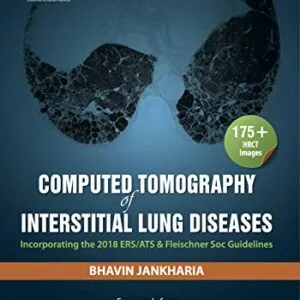 خرید و دانلود نسخه کامل کتاب Computed Tomography of Interstitial Lung Diseases [Print Replica] Kindle Edition