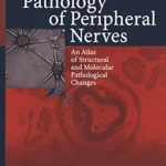 خرید و دانلود نسخه کامل کتاب Pathology of Peripheral Nerves: An Atlas of Structural and Molecular Pathological Changes