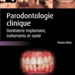 خرید و دانلود نسخه کامل کتاب Parodontologie clinique: Dentisterie implantaire, traitements et santé (French Edition)