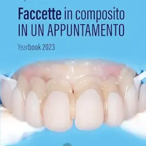 خرید و دانلود نسخه کامل کتاب Faccette in composito in un appuntamento: Yearbook 2023 (Italian Edition)