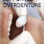 خرید و دانلود نسخه کامل کتاب TOOTH SUPPORTED OVERDENTURE