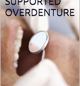 خرید و دانلود نسخه کامل کتاب TOOTH SUPPORTED OVERDENTURE