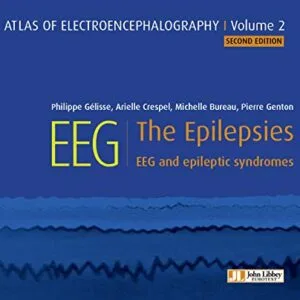 خرید و دانلود نسخه کامل کتاب EEG : The Epilepsies: EEG and epileptic syndromes (Atlas EEG Book 2) Kindle Edition