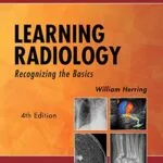 خرید و دانلود نسخه کامل کتاب Learning Radiology: Recognizing the Basics