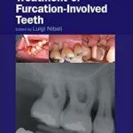 خرید و دانلود نسخه کامل کتاب Diagnosis and Treatment of Furcation-Involved Teeth